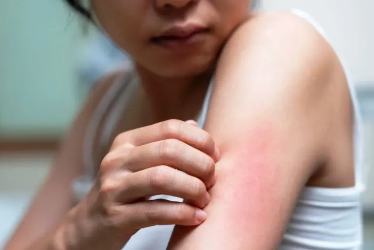 Gatal Tanpa Sebab? 7 Penyakit Serius yang Mungkin Menyebabkan Kulit Terus Gatal