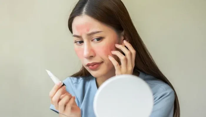 Kulit Wajah Sensitif? Ini 5 Bahan Skincare yang Harus Dihindari